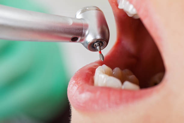 Best Pediatric Emergency Dentist in Markham, IL
